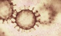 The picture shows the characteristic corona virus microscopically enlarged